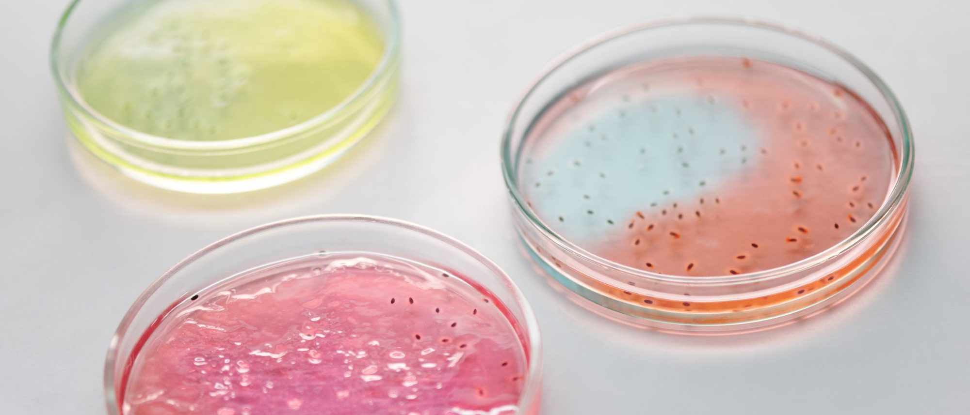 Three petri dishes with cultures in yellow and pink on a white bench.